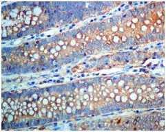 Immunohistochemistry (Formalin/PFA-fixed paraffin-embedded sections) - Anti-TRK fused gene antibody [EPR8765(2)(B)] (AB150428)