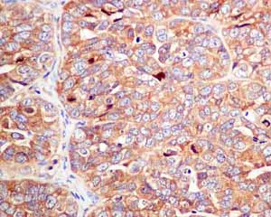 Immunohistochemistry (Formalin/PFA-fixed paraffin-embedded sections) - Anti-TRK fused gene antibody [EPR8765(2)(B)] (AB150428)