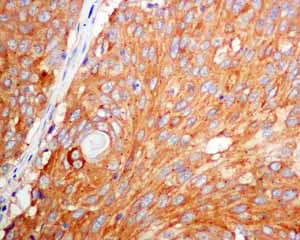 Immunohistochemistry (Formalin/PFA-fixed paraffin-embedded sections) - Anti-TRK fused gene antibody [EPR8765(2)(B)] (AB150428)