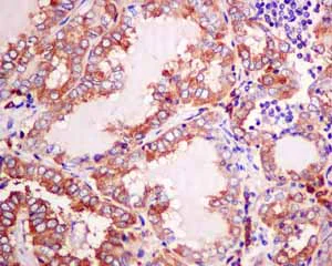 Immunohistochemistry (Formalin/PFA-fixed paraffin-embedded sections) - Anti-TRK fused gene antibody [EPR8765(2)(B)] (AB150428)