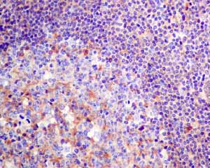 Immunohistochemistry (Formalin/PFA-fixed paraffin-embedded sections) - Anti-TRK fused gene antibody [EPR8765(2)(B)] (AB150428)