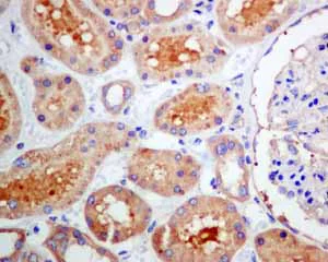 Immunohistochemistry (Formalin/PFA-fixed paraffin-embedded sections) - Anti-TRK fused gene antibody [EPR8765(2)(B)] (AB150428)