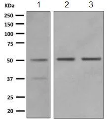 Western blot - Anti-TRK fused gene antibody [EPR8765(2)(B)] (AB150428)