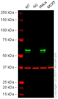 Western blot - Anti-TRK fused gene antibody [EPR8765(2)(B)] (AB150428)