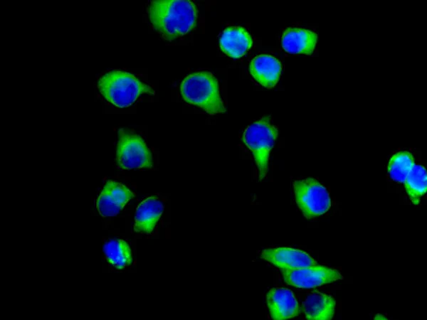 Immunocytochemistry/ Immunofluorescence - Anti-TRK fused gene antibody [EPR8766] (AB156866)