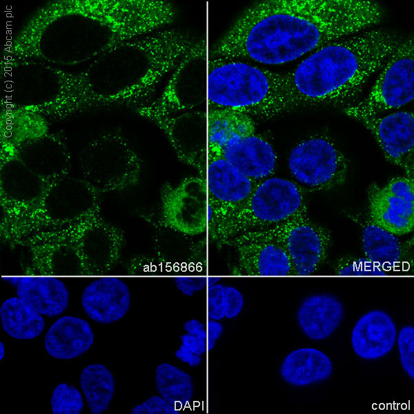 Immunocytochemistry/ Immunofluorescence - Anti-TRK fused gene antibody [EPR8766] (AB156866)