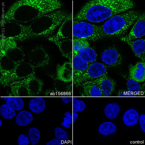 Immunocytochemistry/ Immunofluorescence - Anti-TRK fused gene antibody [EPR8766] (AB156866)