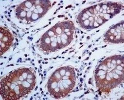 Immunohistochemistry (Formalin/PFA-fixed paraffin-embedded sections) - Anti-TRK fused gene antibody [EPR8766] (AB156866)