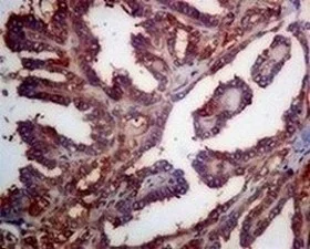 Immunohistochemistry (Formalin/PFA-fixed paraffin-embedded sections) - Anti-TRK fused gene antibody [EPR8766] (AB156866)