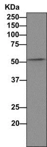 Immunoprecipitation - Anti-TRK fused gene antibody [EPR8766] (AB156866)