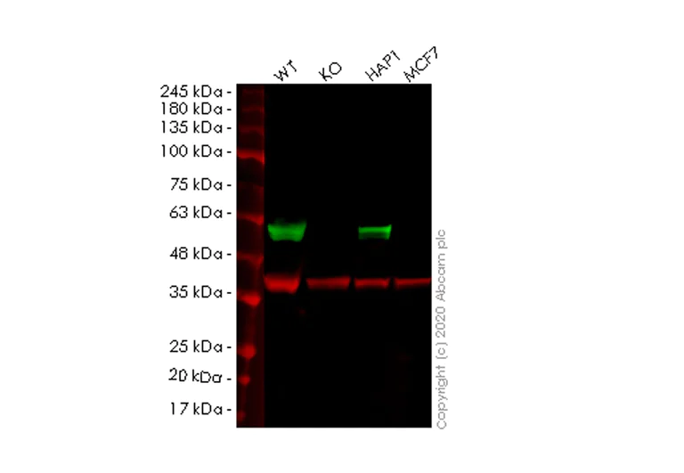 Western blot - Anti-TRK fused gene antibody [EPR8766] (AB156866)
