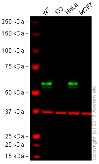 Western blot - Anti-TRK fused gene antibody [EPR8766] - BSA and Azide free (AB235871)