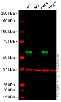 Western blot - Anti-TRK fused gene antibody [EPR8766] - BSA and Azide free (AB235871)