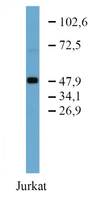 Western blot - Anti-TRK fused gene antibody [TFG-03] (AB288673), expandable thumbnail