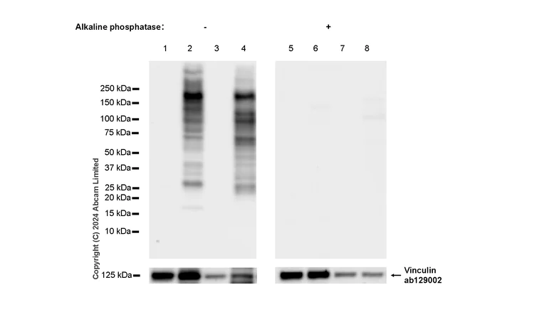 Western blot - Anti-TrkA (phospho Y496+Y674)+TrkB (phospho Y516+Y706)+TrkC (phospho Y516+Y709) antibody [RM1160] (AB322462)