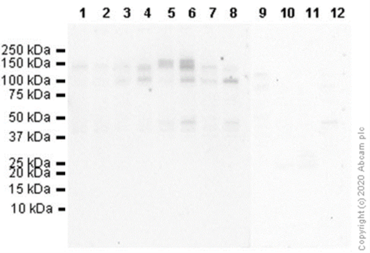Western blot - Anti-TrkA (phospho Y674)+TrkB (phospho Y706)+TrkC (phospho Y709) antibody [EPR22298-67] (AB229908), expandable thumbnail