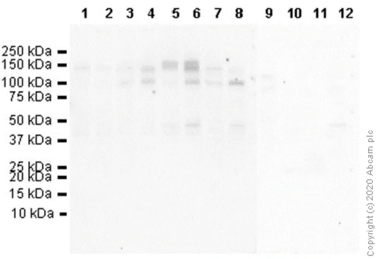 Western blot - Anti-TrkA (phospho Y674)+TrkB (phospho Y706)+TrkC (phospho Y709) antibody [EPR22298-67] (AB229908)