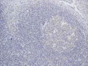 Immunohistochemistry (Formalin/PFA-fixed paraffin-embedded sections) - Anti-TrkA + TrkB antibody [EPR1104(2)] (AB109010)