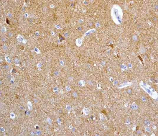 Immunohistochemistry (Formalin/PFA-fixed paraffin-embedded sections) - Anti-TrkA + TrkB antibody [EPR1104(2)] (AB109010)