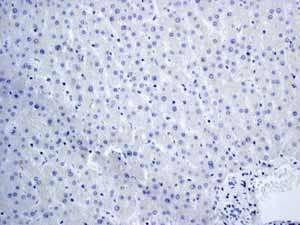 Immunohistochemistry (Formalin/PFA-fixed paraffin-embedded sections) - Anti-TrkA + TrkB antibody [EPR1104(2)] (AB109010)