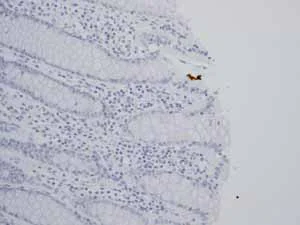 Immunohistochemistry (Formalin/PFA-fixed paraffin-embedded sections) - Anti-TrkA + TrkB antibody [EPR1104(2)] (AB109010)