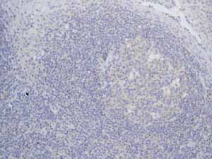 Immunohistochemistry (Formalin/PFA-fixed paraffin-embedded sections) - Anti-TrkA + TrkB antibody [EPR1104(2)] - BSA and Azide free (ab247744), expandable thumbnail