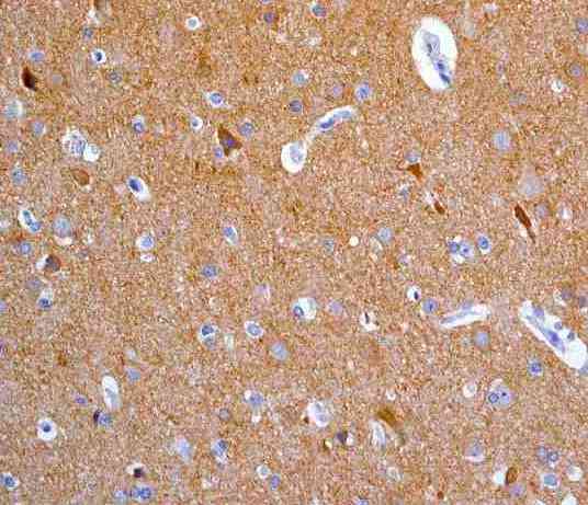 Immunohistochemistry (Formalin/PFA-fixed paraffin-embedded sections) - Anti-TrkA + TrkB antibody [EPR1104(2)] - BSA and Azide free (AB247744), expandable thumbnail