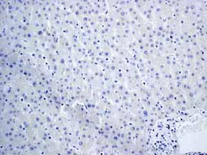 Immunohistochemistry (Formalin/PFA-fixed paraffin-embedded sections) - Anti-TrkA + TrkB antibody [EPR1104(2)] - BSA and Azide free (AB247744)