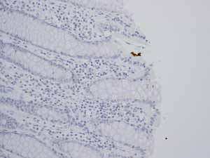 Immunohistochemistry (Formalin/PFA-fixed paraffin-embedded sections) - Anti-TrkA + TrkB antibody [EPR1104(2)] - BSA and Azide free (ab247744), expandable thumbnail