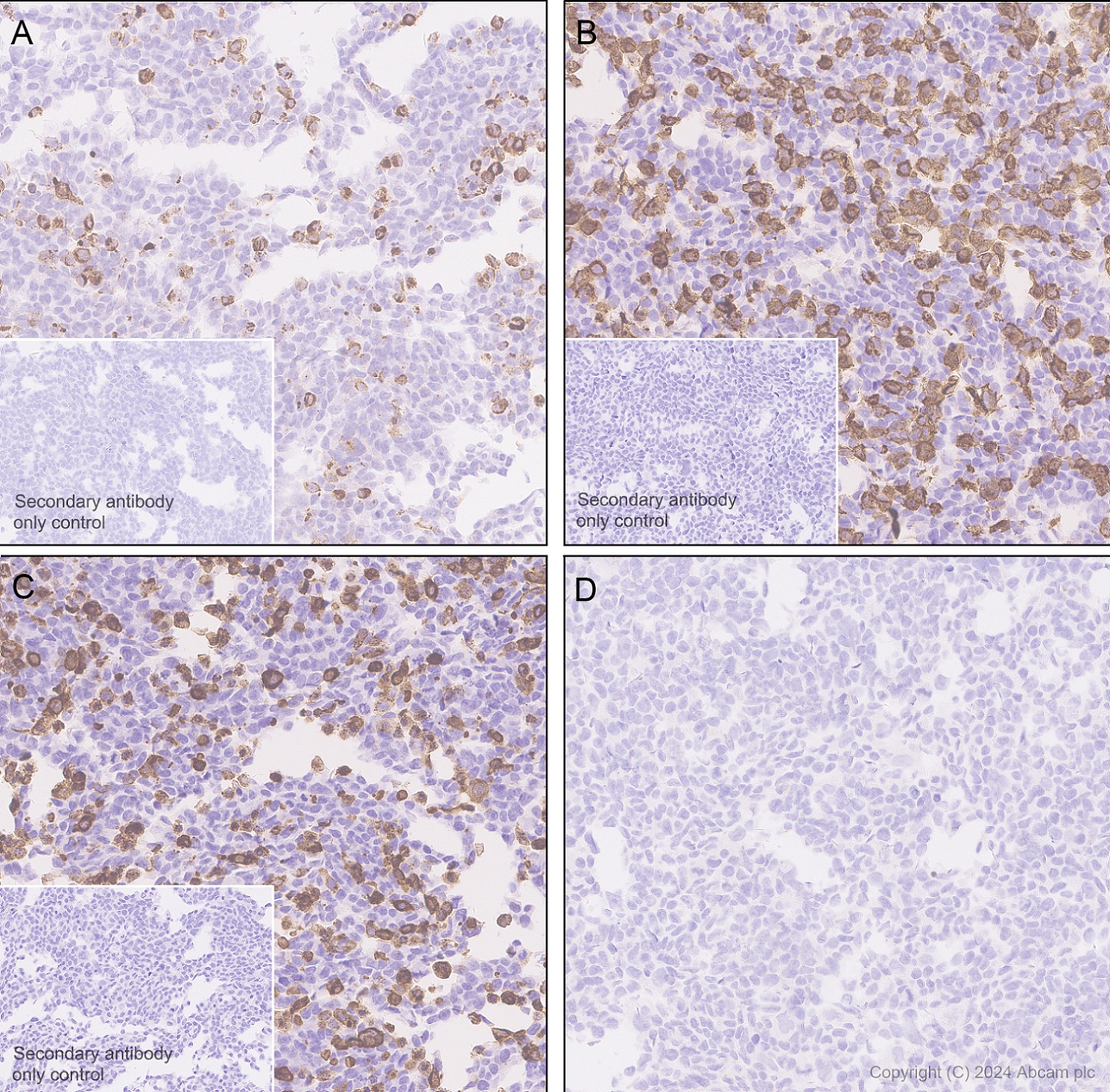 Immunohistochemistry (Formalin/PFA-fixed paraffin-embedded sections) - Anti-TrkA(pY674/Y675)+TrkB(pY706/Y707)+TrkC(pY709/Y710) antibody [EPR28220-108] (AB316756), expandable thumbnail