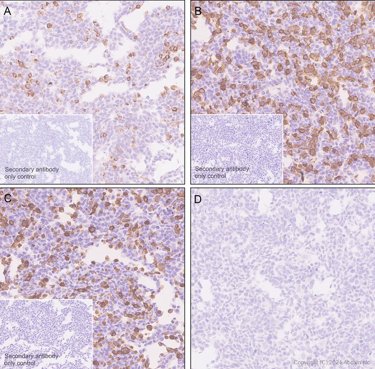 Immunohistochemistry (Formalin/PFA-fixed paraffin-embedded sections) - Anti-TrkA(pY674/Y675)+TrkB(pY706/Y707)+TrkC(pY709/Y710) antibody [EPR28220-108] (AB316756)