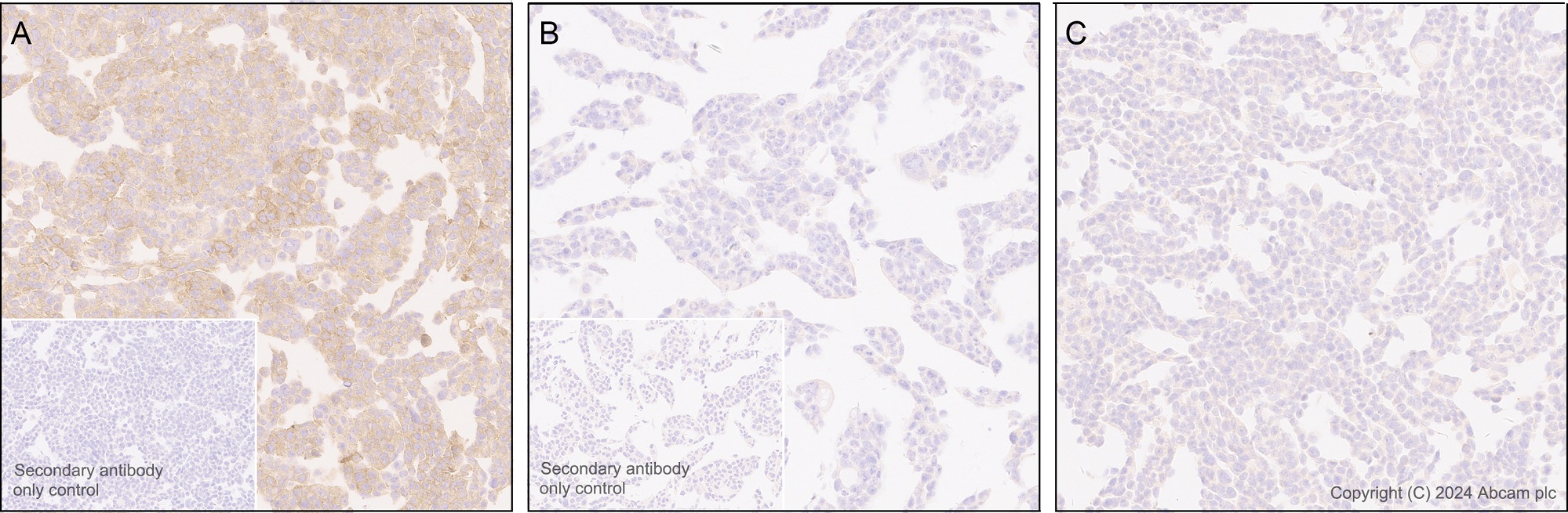 Immunohistochemistry (Formalin/PFA-fixed paraffin-embedded sections) - Anti-TrkA(pY674/Y675)+TrkB(pY706/Y707)+TrkC(pY709/Y710) antibody [EPR28220-108] (AB316756), expandable thumbnail
