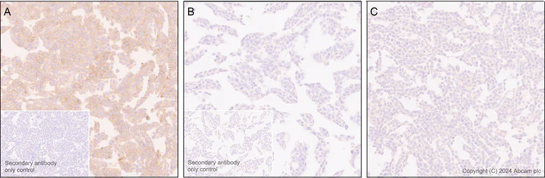 Immunohistochemistry (Formalin/PFA-fixed paraffin-embedded sections) - Anti-TrkA(pY674/Y675)+TrkB(pY706/Y707)+TrkC(pY709/Y710) antibody [EPR28220-108] - BSA and Azide free (AB316757)