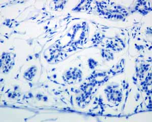 Immunohistochemistry (Formalin/PFA-fixed paraffin-embedded sections) - Anti-TrkB antibody [EPR1294] (AB134155)