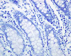 Immunohistochemistry (Formalin/PFA-fixed paraffin-embedded sections) - Anti-TrkB antibody [EPR1294] (AB134155)