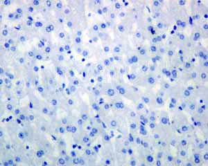 Immunohistochemistry (Formalin/PFA-fixed paraffin-embedded sections) - Anti-TrkB antibody [EPR1294] (AB134155)