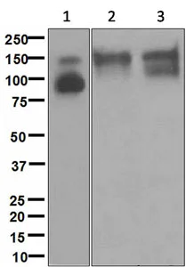 Western blot - Anti-TrkB antibody [EPR1294] (AB134155)