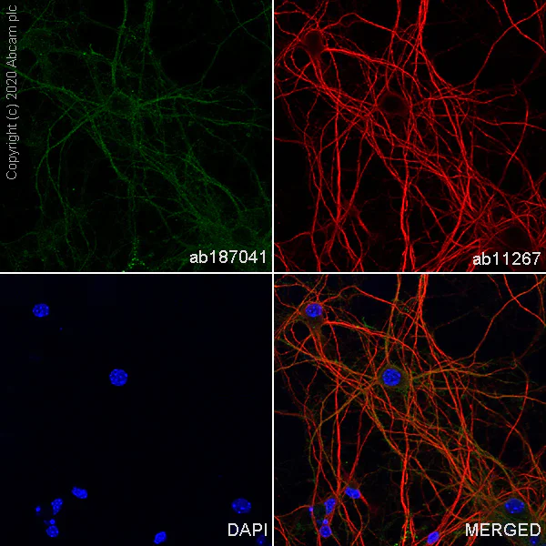 Immunocytochemistry/ Immunofluorescence - Anti-TrkB antibody [EPR17805-146] (AB187041)