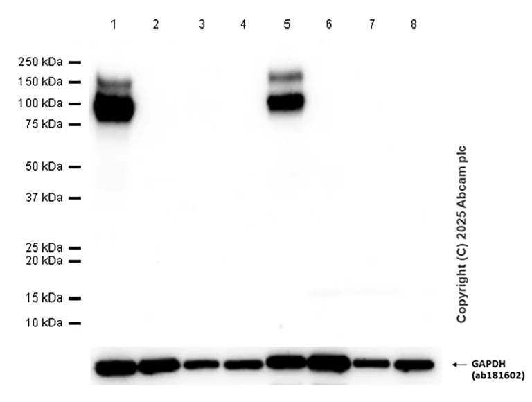 Western blot - Anti-TrkB antibody [EPR17805-146] (AB187041)