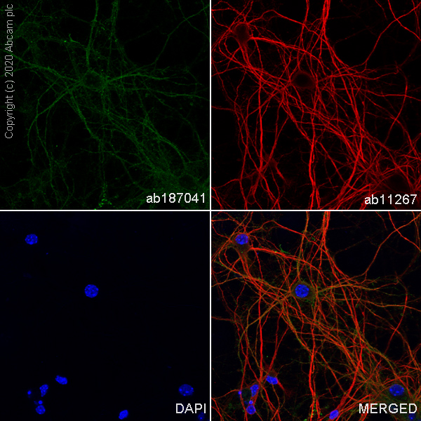 Immunocytochemistry/ Immunofluorescence - Anti-TrkB antibody [EPR17805-146] - Low endotoxin, Azide free (AB223155), expandable thumbnail