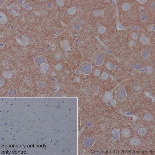 Immunohistochemistry (Formalin/PFA-fixed paraffin-embedded sections) - Anti-TrkB antibody [EPR17805-146] - Low endotoxin, Azide free (AB223155), expandable thumbnail