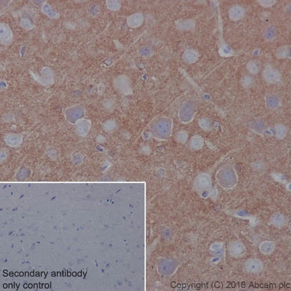 Immunohistochemistry (Formalin/PFA-fixed paraffin-embedded sections) - Anti-TrkB antibody [EPR17805-146] - Low endotoxin, Azide free (AB223155)