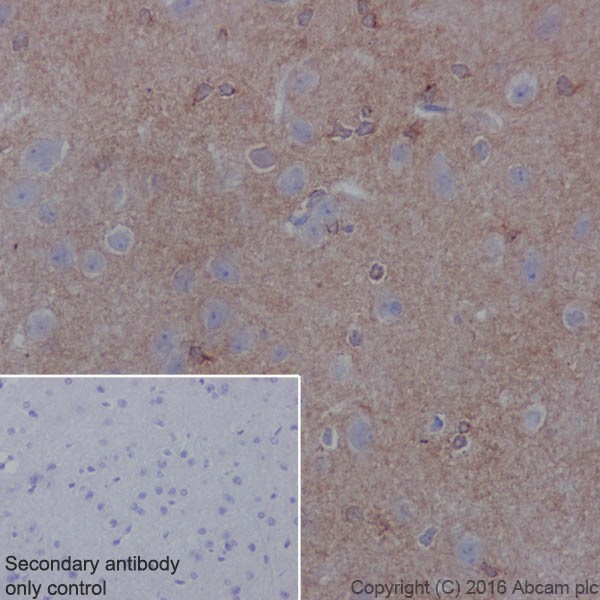 Immunohistochemistry (Formalin/PFA-fixed paraffin-embedded sections) - Anti-TrkB antibody [EPR17805-146] - Low endotoxin, Azide free (ab223155), expandable thumbnail