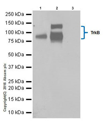 Immunoprecipitation - Anti-TrkB antibody [EPR17805-146] - Low endotoxin, Azide free (ab223155), expandable thumbnail