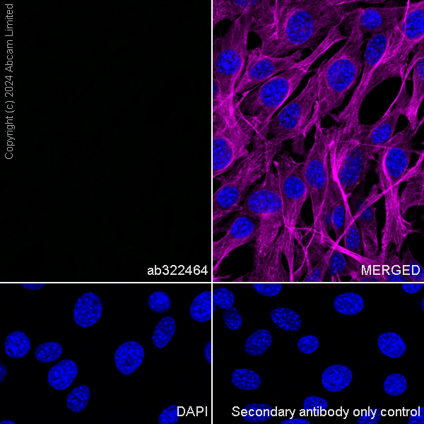 Immunocytochemistry/ Immunofluorescence - Anti-TrkB antibody [RM1253] (ab322464), expandable thumbnail
