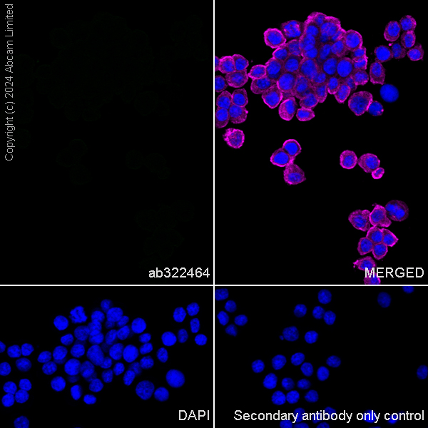 Immunocytochemistry/ Immunofluorescence - Anti-TrkB antibody [RM1253] (ab322464), expandable thumbnail