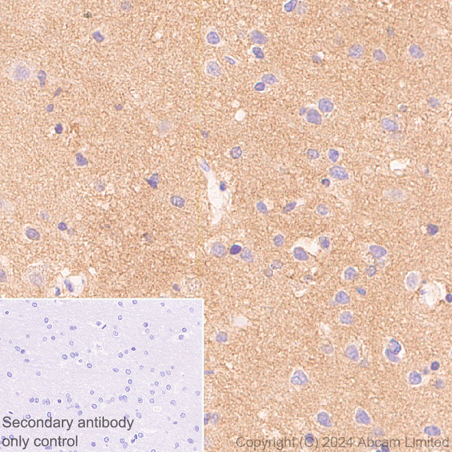 Immunohistochemistry (Formalin/PFA-fixed paraffin-embedded sections) - Anti-TrkB antibody [RM1253] (ab322464), expandable thumbnail