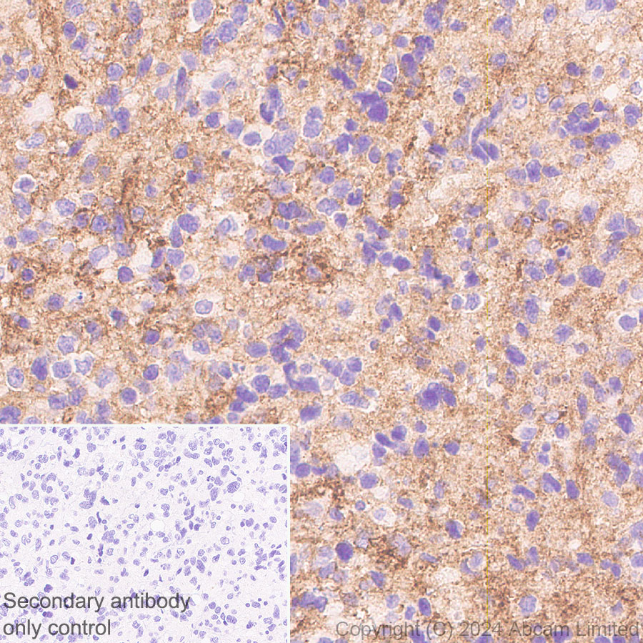Immunohistochemistry (Formalin/PFA-fixed paraffin-embedded sections) - Anti-TrkB antibody [RM1253] (AB322464), expandable thumbnail
