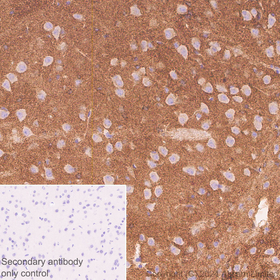 Immunohistochemistry (Formalin/PFA-fixed paraffin-embedded sections) - Anti-TrkB antibody [RM1253] (ab322464), expandable thumbnail