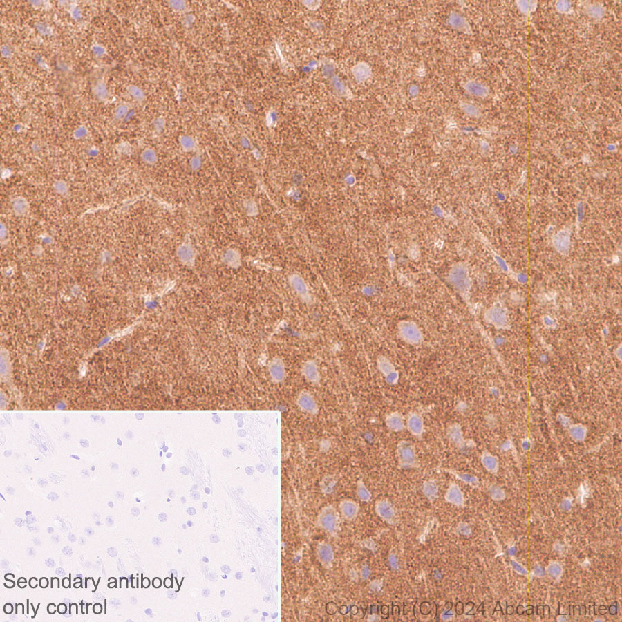 Immunohistochemistry (Formalin/PFA-fixed paraffin-embedded sections) - Anti-TrkB antibody [RM1253] (ab322464), expandable thumbnail